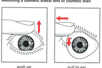 Diagram showing how to remove a cosmetic shell