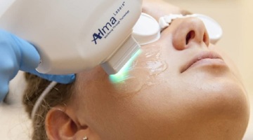 A woman having IPL Treatment For Dry Eyes