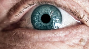 An image of an eye