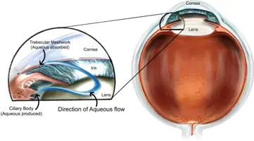 Diagram of Selective Laser Trabeculoplasty