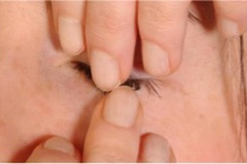 Scleral Contact Lens insertion