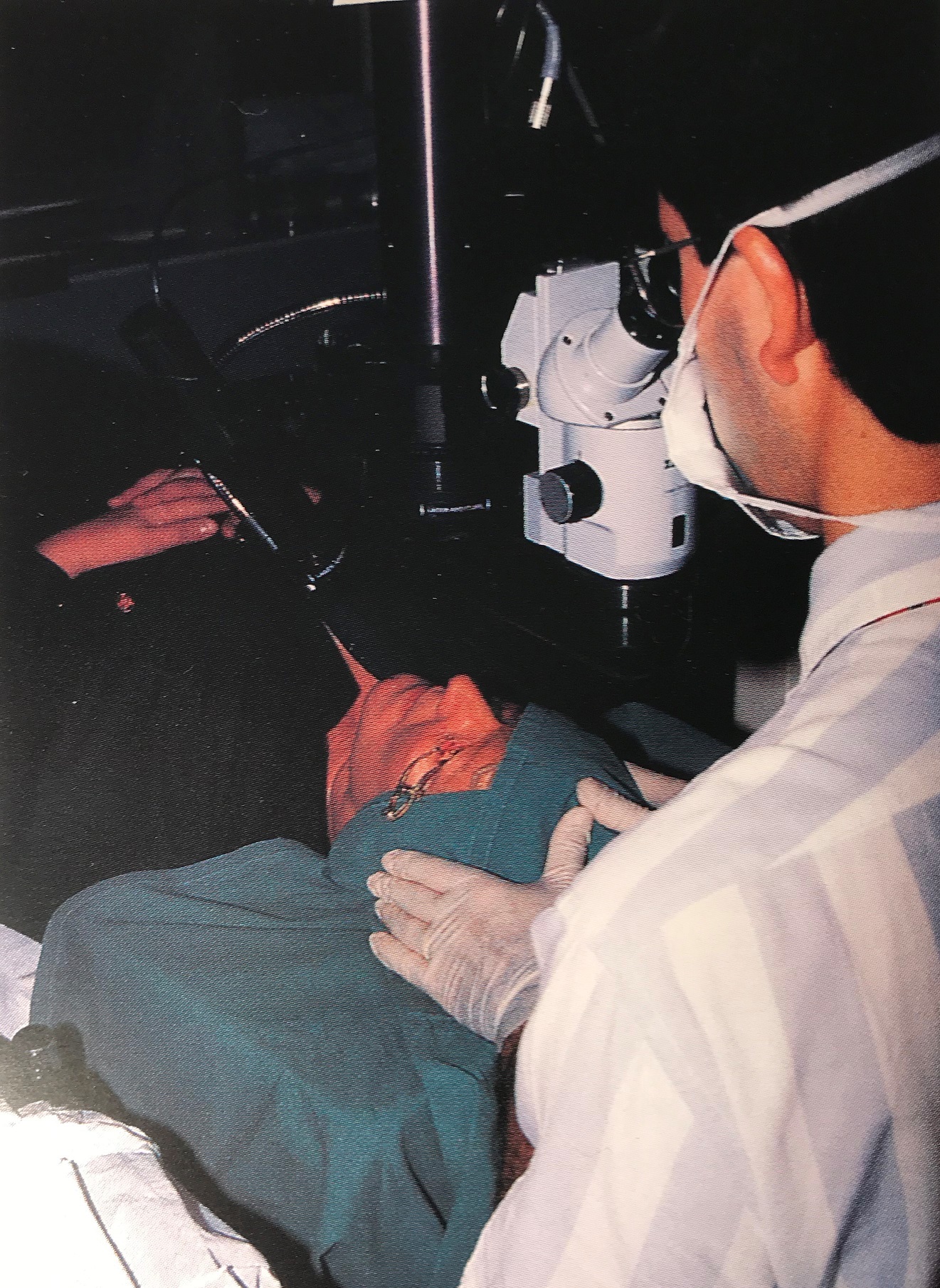 Professor Gartry performing the very first excimer laser PRK treatment in the UK in November 1989.
