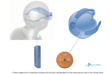 Diagram of a device that enables people with AMD to regain some vision