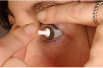 Contact Lens  suction removal