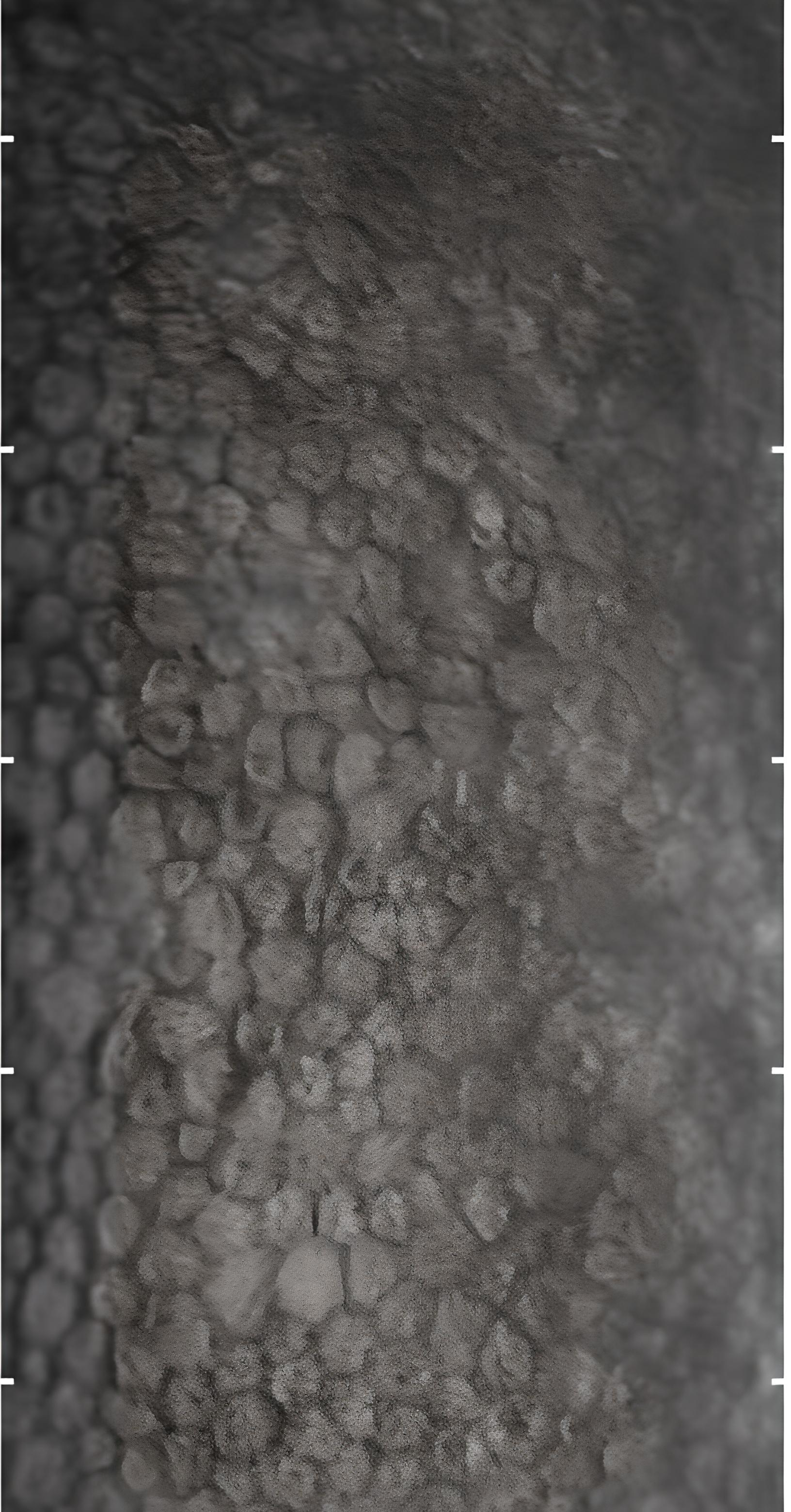Image of endothelium cells